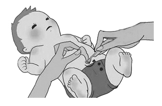 新生儿护理不可忽略的几个问题