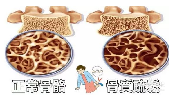 蛋白质摄入过量有什么危害呢