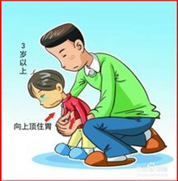 饮食安全(孩子篇6)——食物卡住喉咙急救法