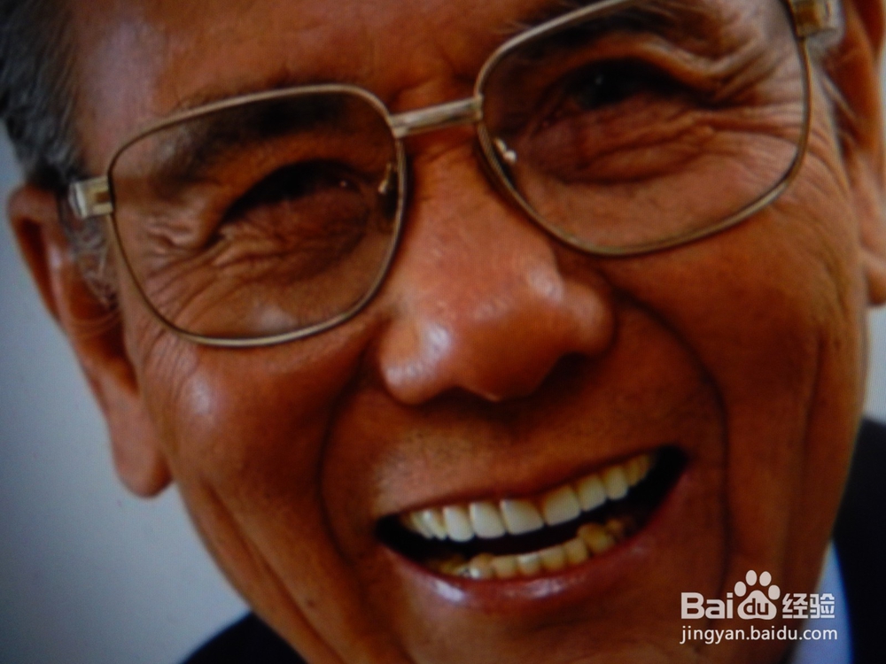 怎么提高血管“年轻化”，防止变老？