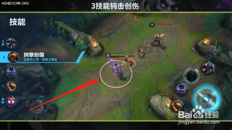 英雄联盟蒙多重做技能介绍