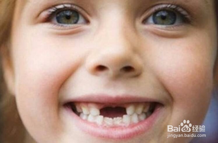 孩子换牙时该注意些什么？