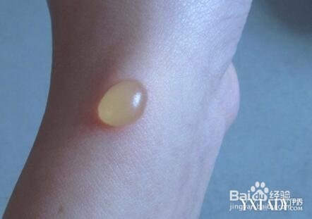 高温天气不要轻易触碰的东西