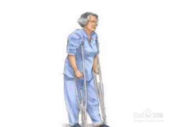 关节置换后怎样康复锻炼