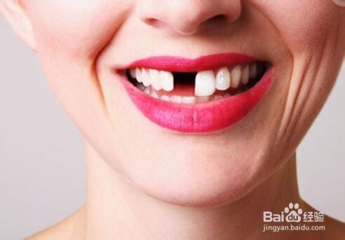 牙齿松动治疗方法