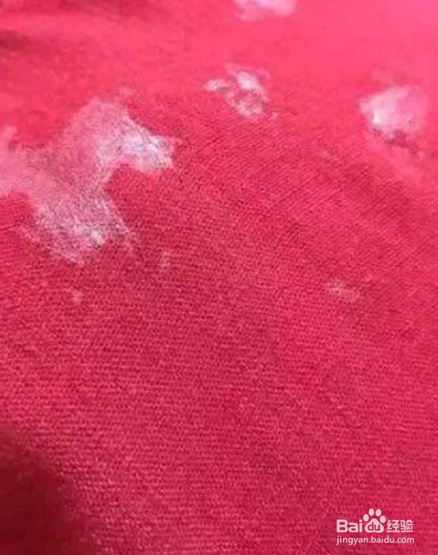 衣服上的胶怎么才能下来