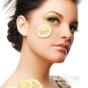 脂溢性皮炎后期症状