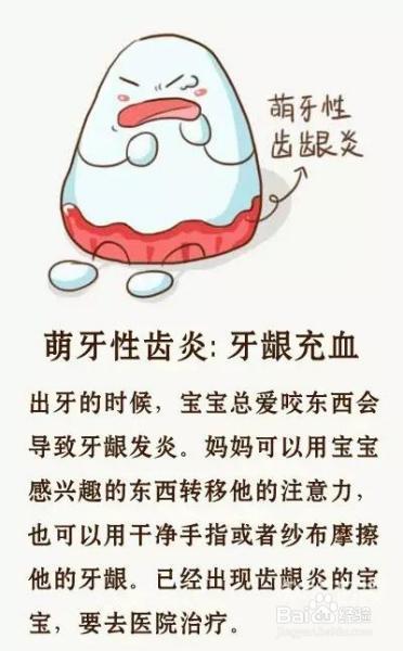 鉴别宝宝牙齿健康状况超简单，要不你也试试？