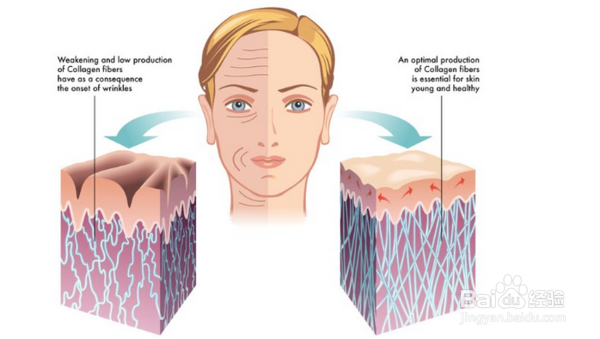 电波拉皮影响哺乳吗？