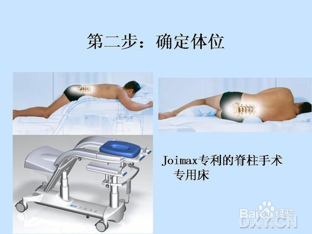 椎间孔镜的治疗