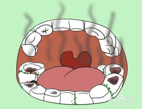 7个引起口臭的原因和治疗方法