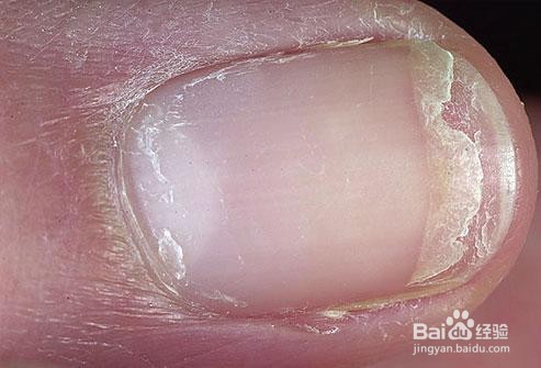 涂指甲油的危害！