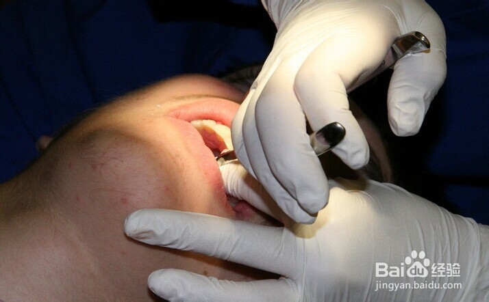 土单验方——口腔科：[2]牙质过敏等