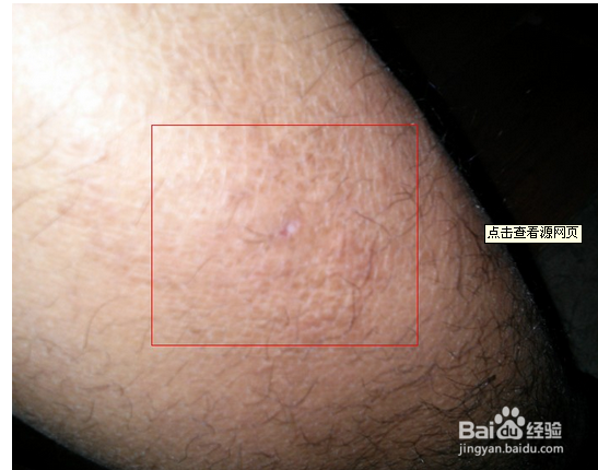 冬天腿部干痒怎么办