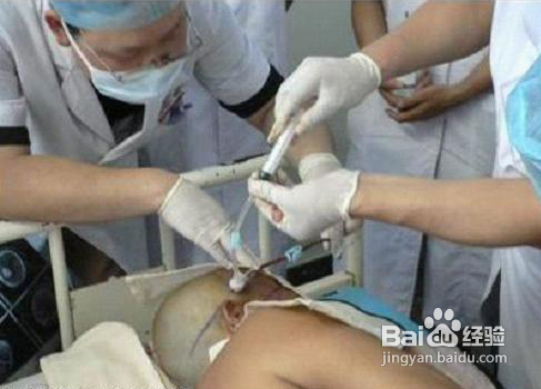 动脉穿刺操作的方法与步骤