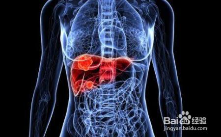 体检查出肝囊肿，究竟是不是肿瘤？你需要知道这些！