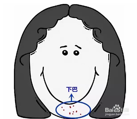 祛痘的图解,祛痘要坚持