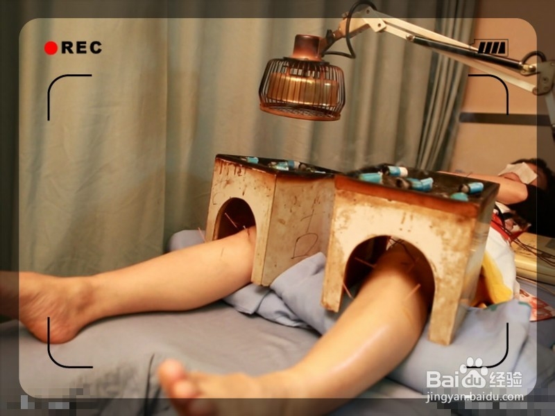 羽毛球运动时扭到了脚踝怎么办？