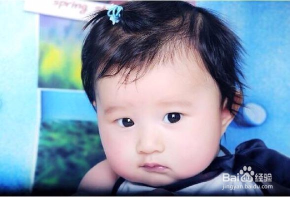 宝宝起湿疹为什么治不好