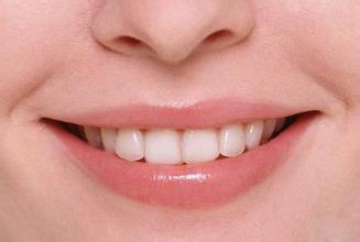 冷光美白八项注意!