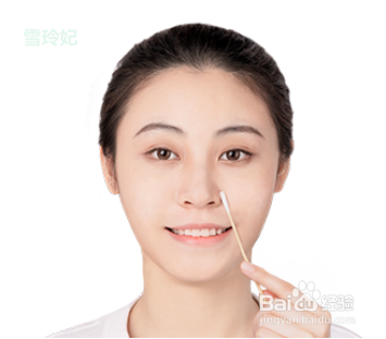 如何改善草莓鼻
