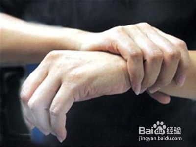 手指麻木是什么原因引起的