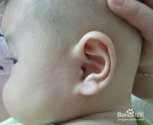 哪些可能性因素会使宝宝致聋