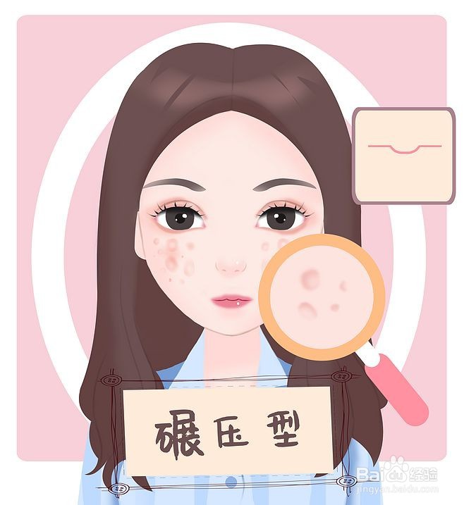 什么是碾压型痘坑？有什么危害？
