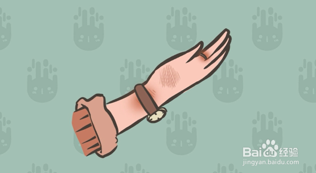 烫伤后的正确处理方法有哪些？