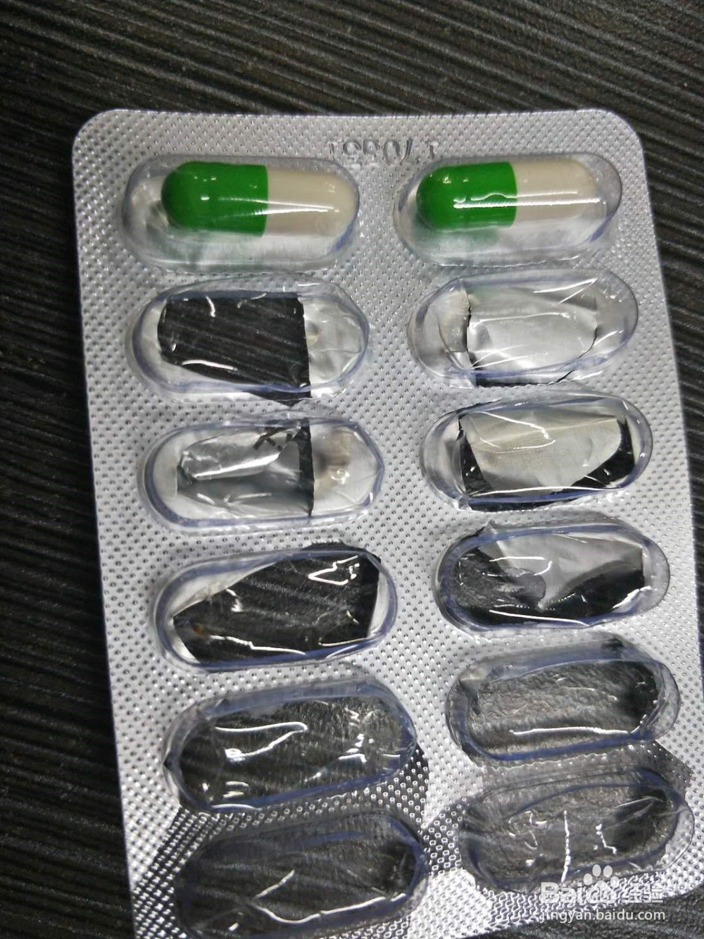 口腔溃疡怎么治疗
