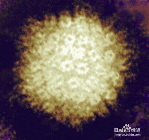 带状疱疹的疼痛为什么剧烈持久