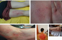 refa刮痧板使用教程