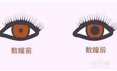孩子散瞳验光的注意事项