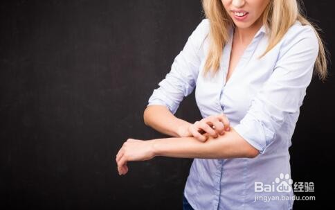 如何分辨湿疹和癣