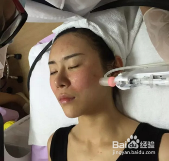 长痘不怕，教您祛痘印的美容项目