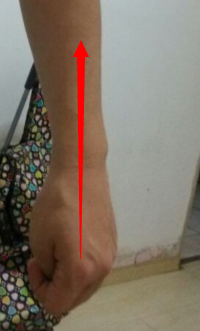 敲大肠经治便秘