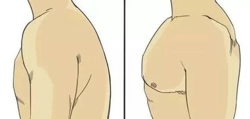 圆肩怎么矫正