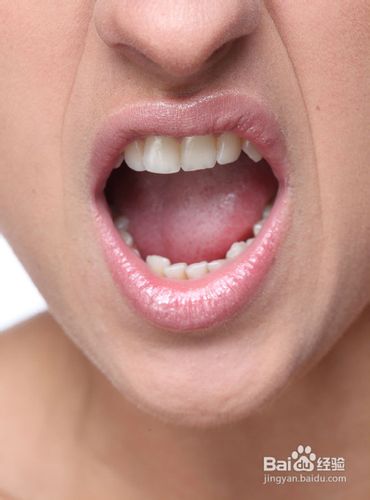 远离口腔溃疡“火”不得