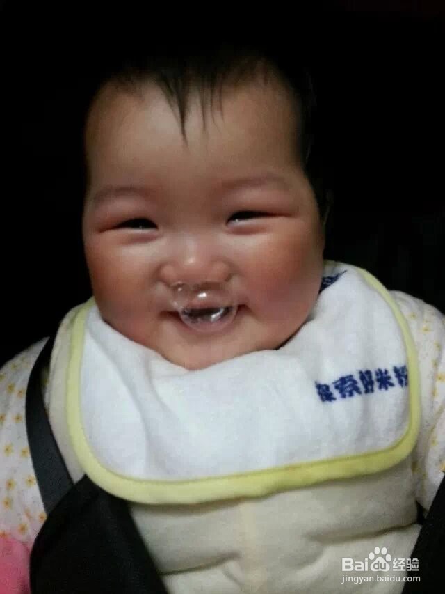 怎样处理宝宝的感冒问题