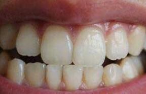 地包天有哪些危害