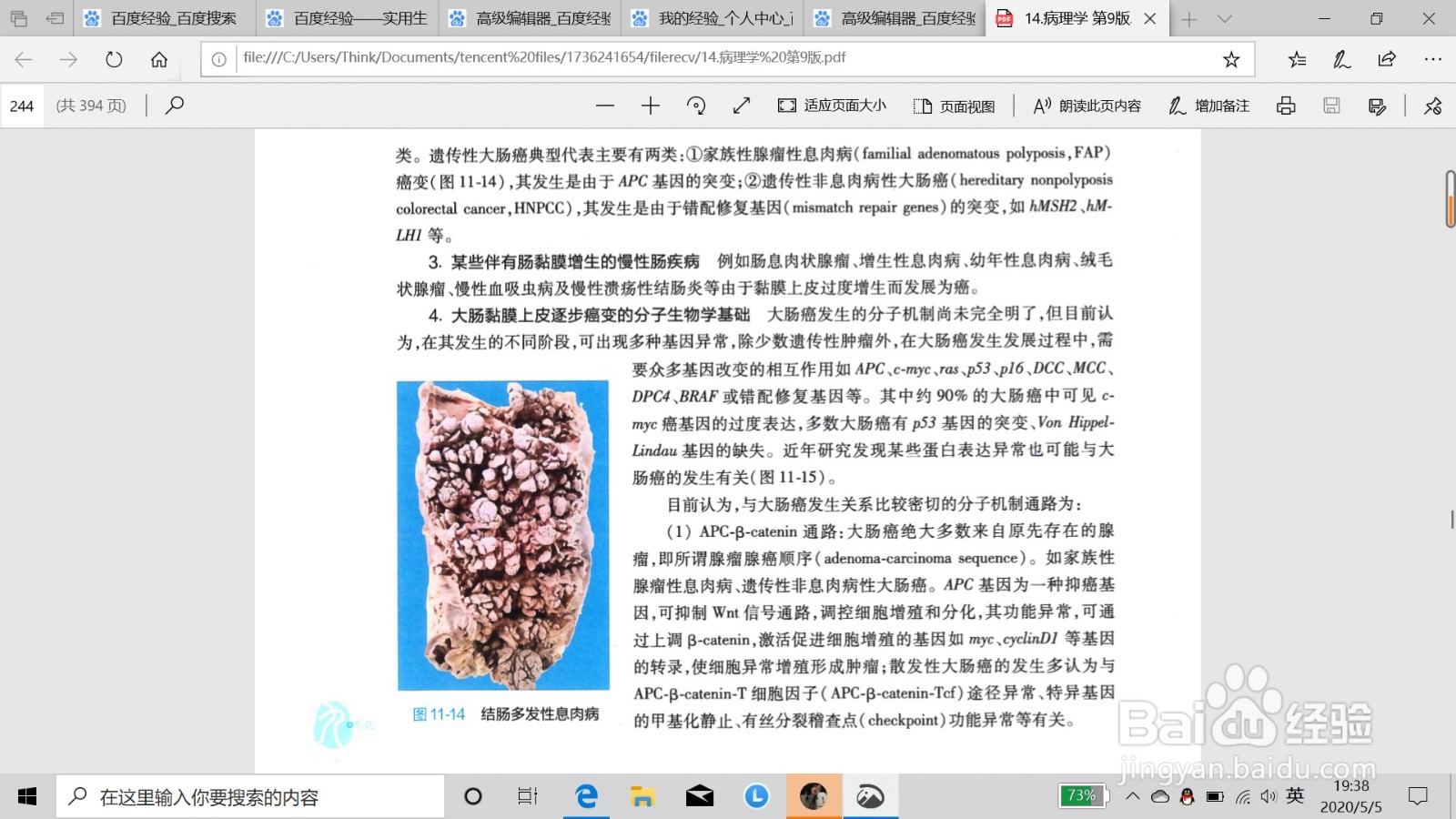 如何鉴别肠癌