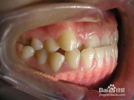 宝宝要不要睡觉前吃奶喂奶