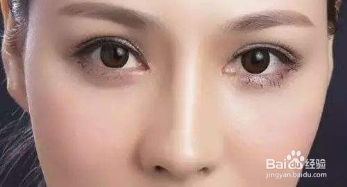 什么人不适合做切开式双眼皮