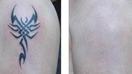 纹身后悔了怎么办