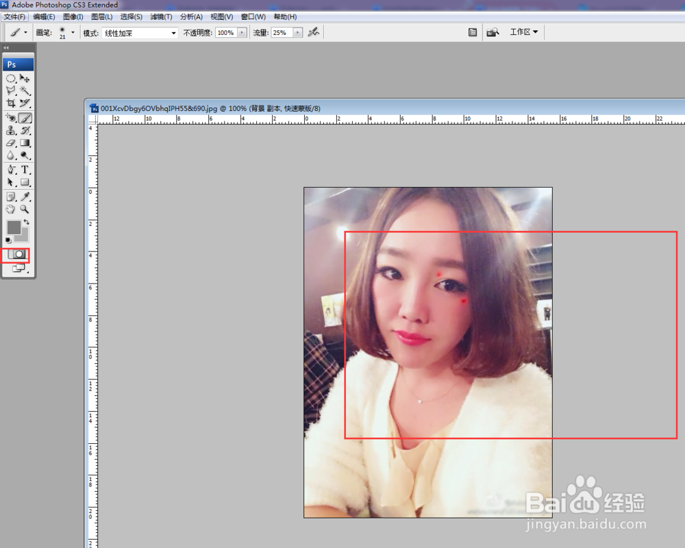 如何去除脸上的痦子?