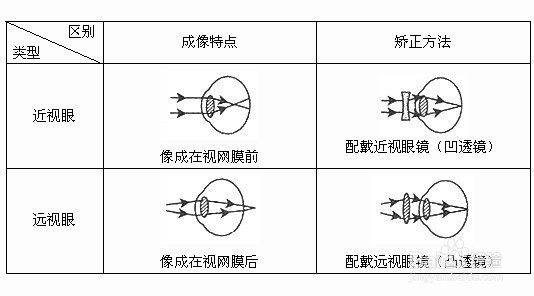 造成近视原因有那些?