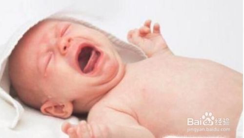 宝宝缺钙会表现出哪些症状