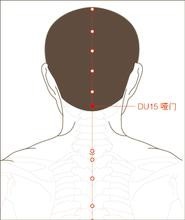 颈椎病的预防和调理