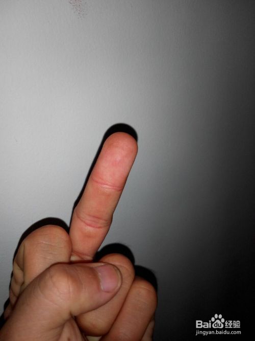 人的手五个指头分别叫什么 那个是正面和反面 百度经验 人的手五个指头分别叫什么 那个是正面和反面 百度经验