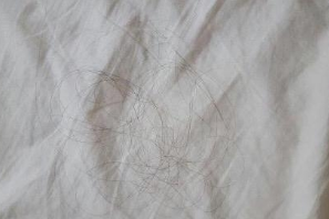 头发掉落的原因？